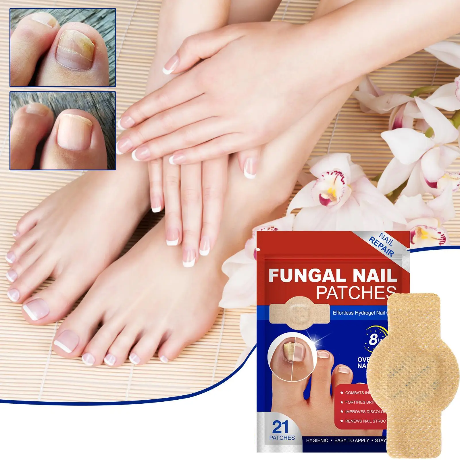 NailPatch 1+1 GRATIS - Schimmelwerend, Antibacterieel Nagelverzorging Patch Pak